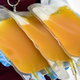 A nurse holding up plasma donated by a man who recovered from covid-19 on August 14, 2020 in Bogotá, Colombia.